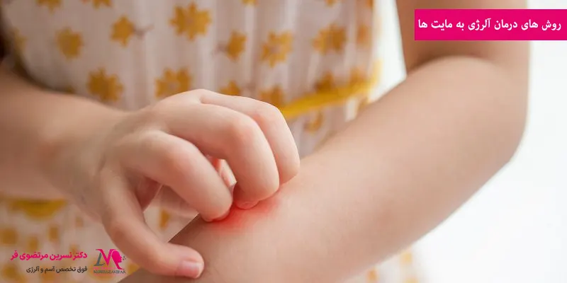 روش های درمان آلرژی به مایت ها