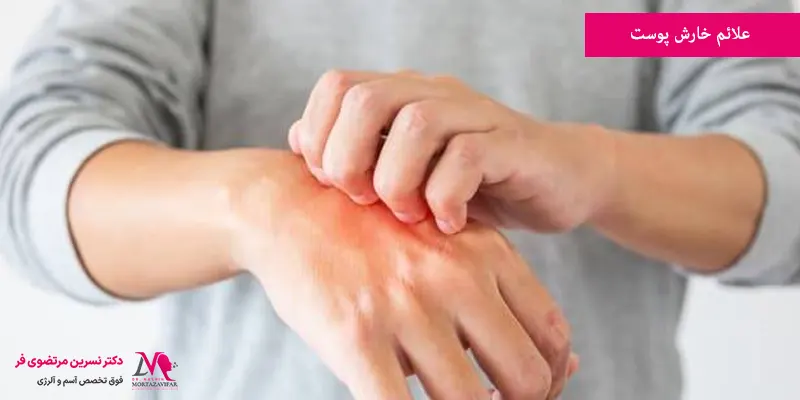 علائم خارش پوست