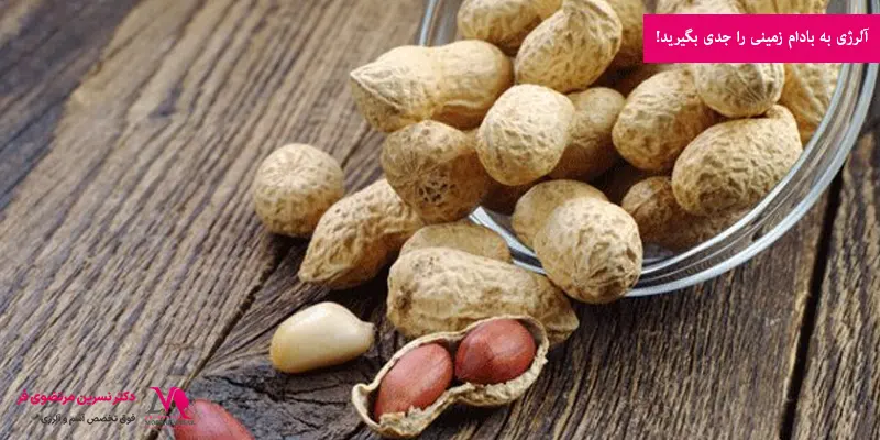 آلرژی به بادام زمینی را جدی بگیرید!