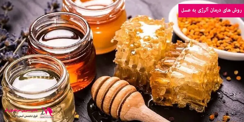 روش های درمان آلرژی به عسل