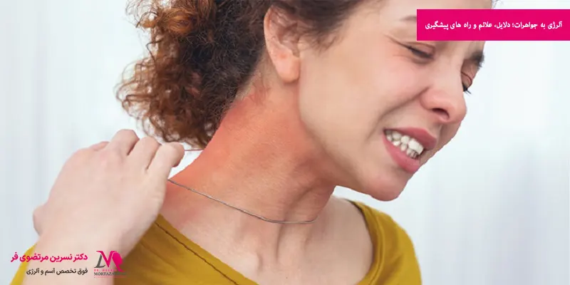 آلرژی به جواهرات؛ دلایل، علائم و راه های پیشگیری